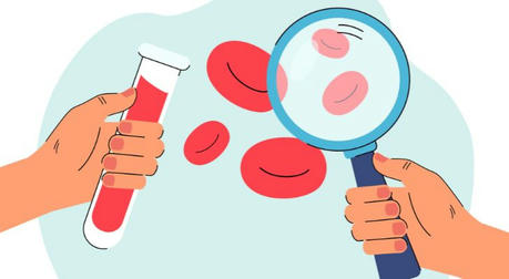 The Silent Battle Against Leukemia: Prevention, Treatments, and Hope