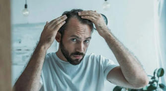 The UK's Hair Loss Crisis: How 6 Million Brits Are Finding New Hope with Regenerative Hair Transplants